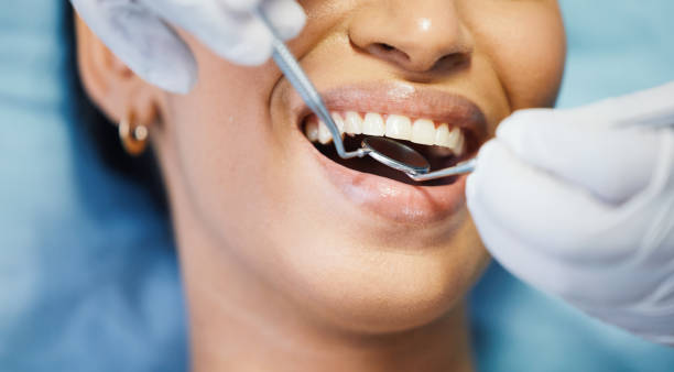 Best Weekend Emergency Dentist in Lake Marcel Stillter, WA