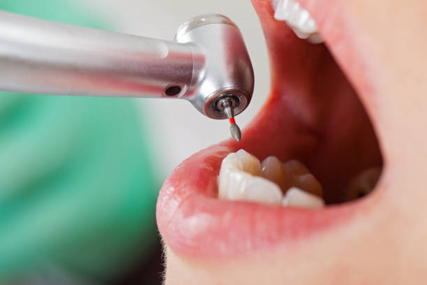 Best Emergency Treatment for Toothache in Lake Marcel Stillter, WA